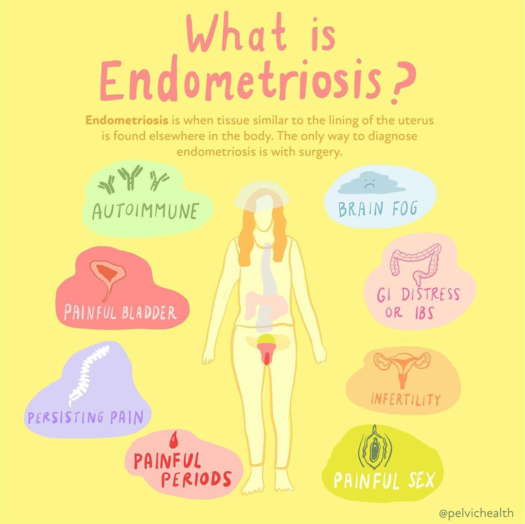 Endometriosis